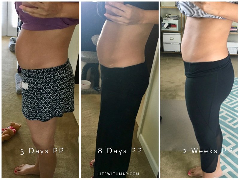 Bellefit postpartum girdle before and after results. Click to read the full review and see what I liked and didn't! 